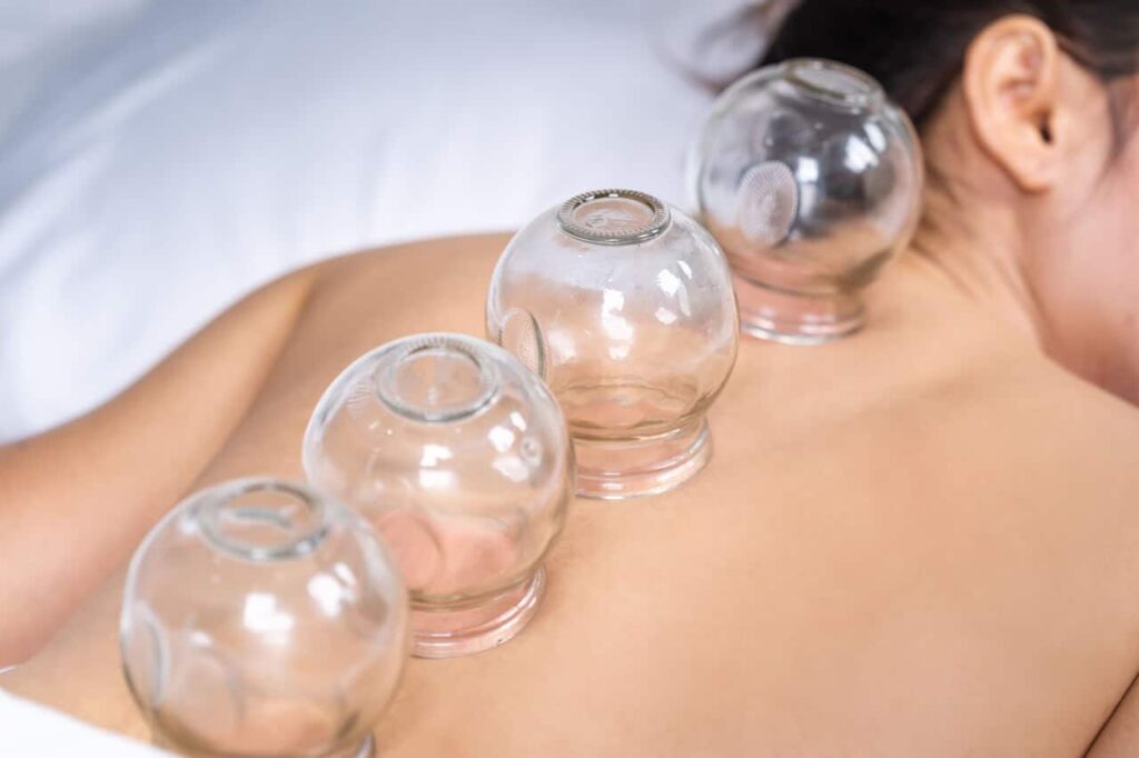 Cupping Light Massage RMT Clinic Toronto1